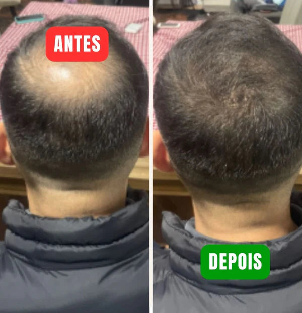 KARA CONCEALER - ¡RECUPERA TU CABELLO EN MINUTOS!